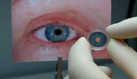 Εγκρίθηκε στις ΗΠΑ η πρώτη τεχνητή ίριδα για τα μάτια