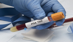 Τι είναι το PSA; (Prostate Specific Antigen)
